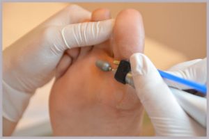 Pedicure Leeuwarden